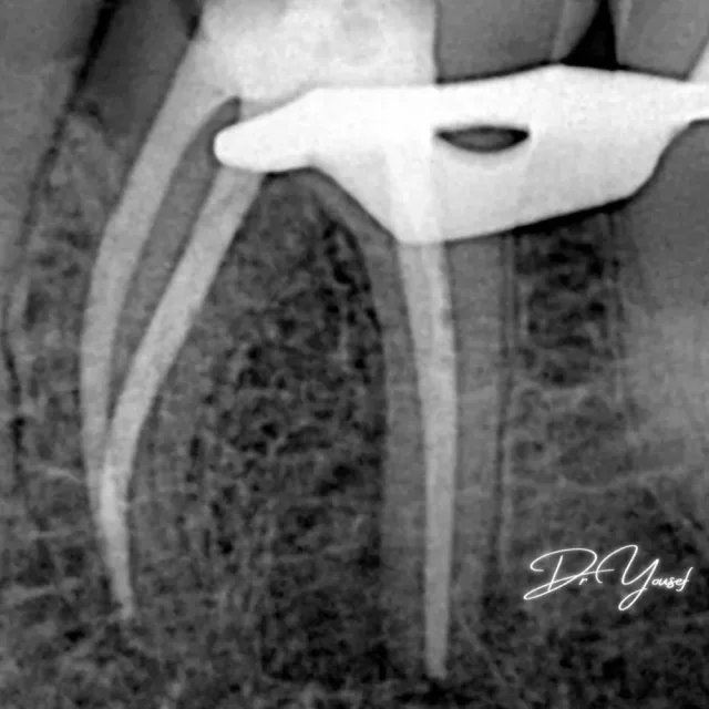 Dr Yousef Alramahi Dental Clinic