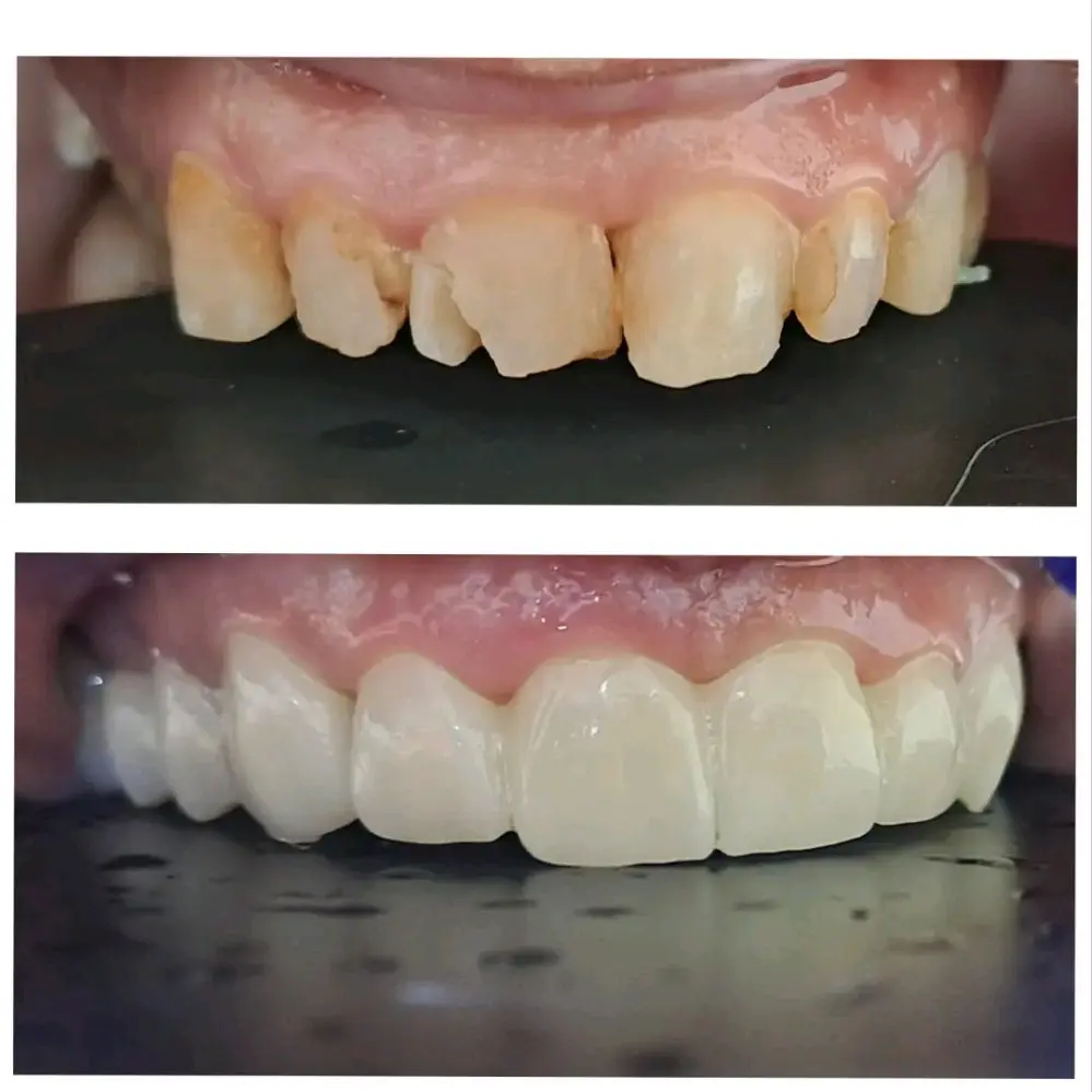 صانع أبتسامة
