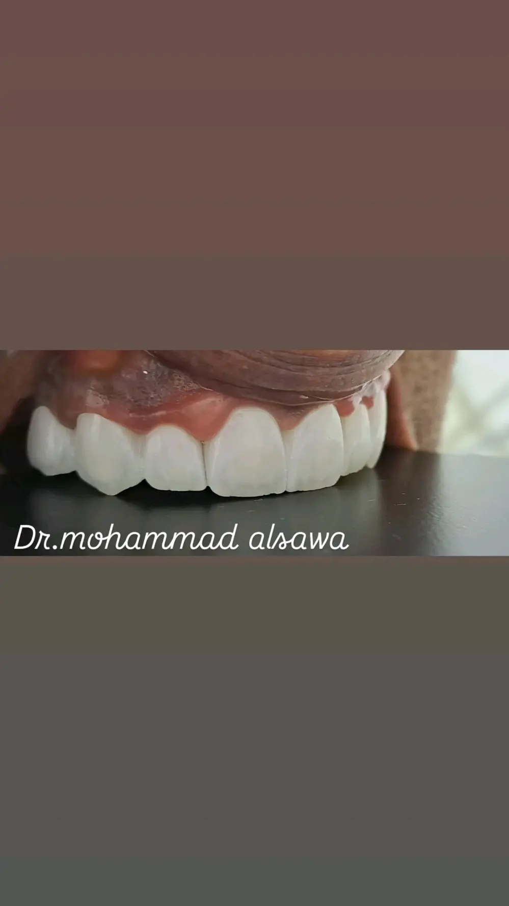 صانع أبتسامة