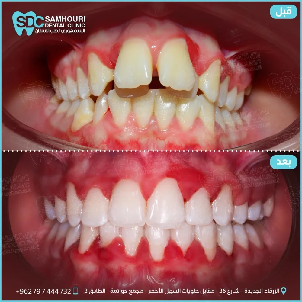 د.عبدالله السمهوري لطب وتقويم الأسنان