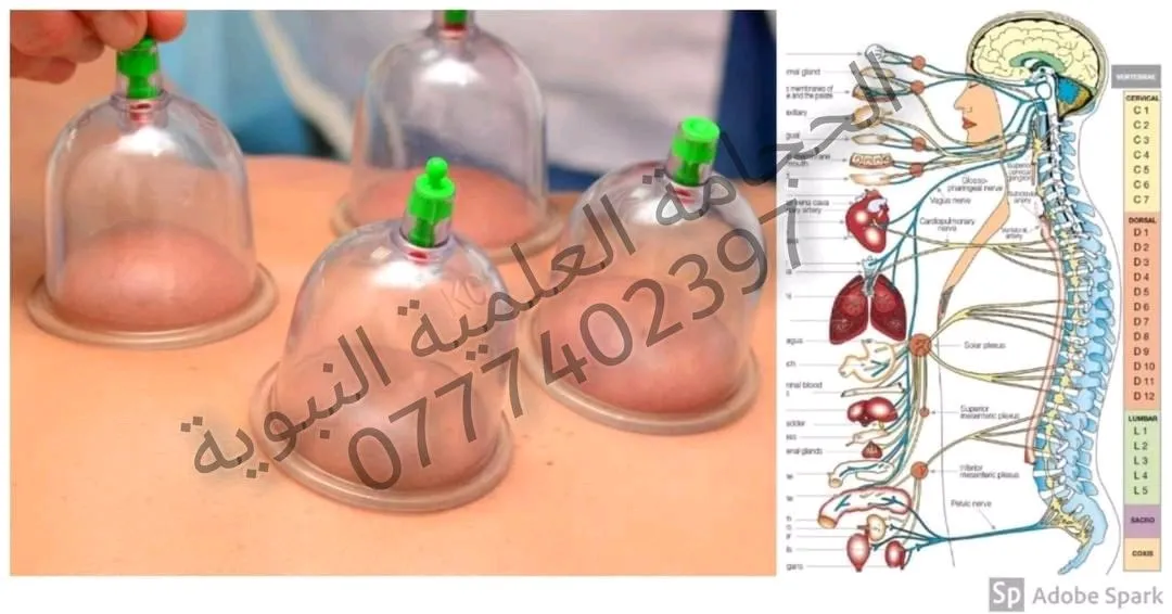 الحجامة العلمية النبوية