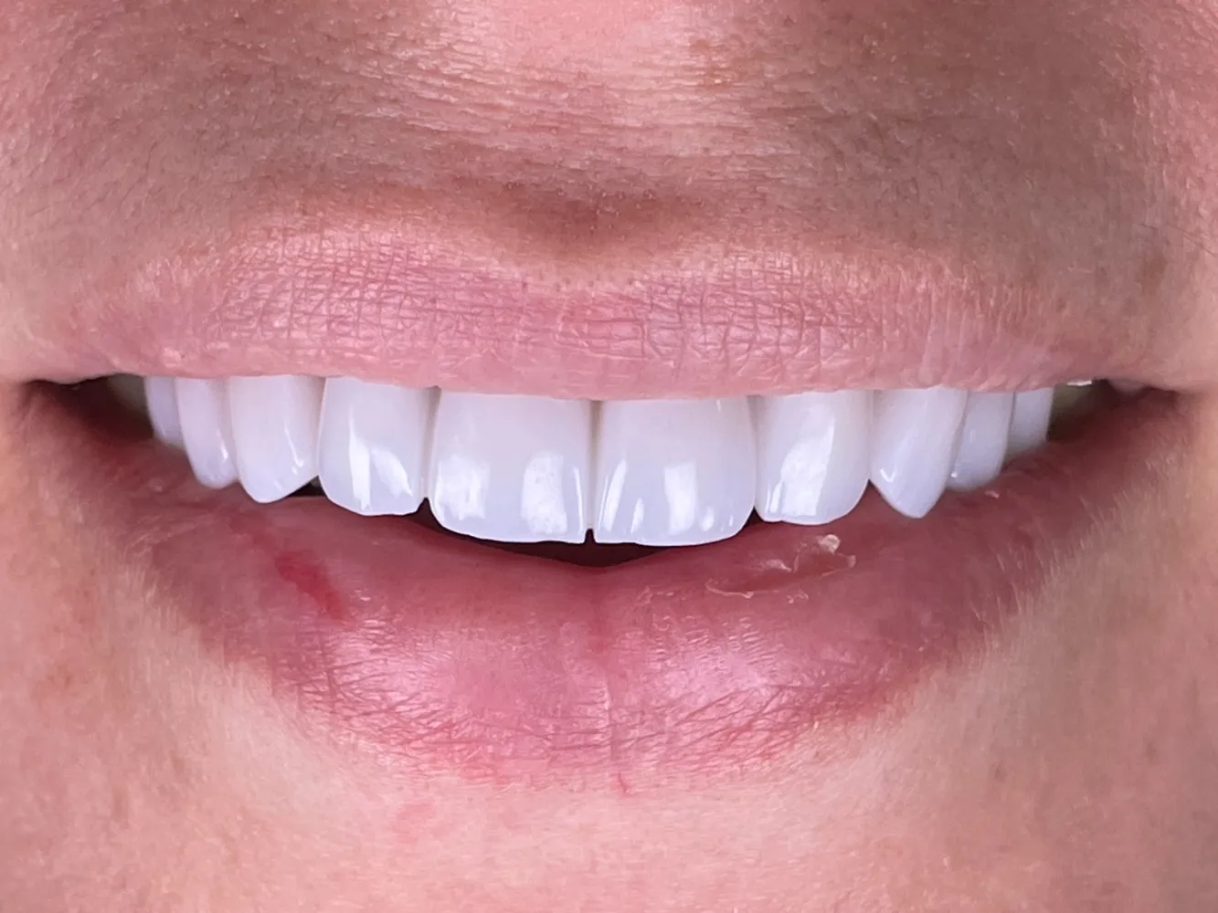 عيادة أسنان ، الدكتور نضال خليفة ، طبيب أسنان