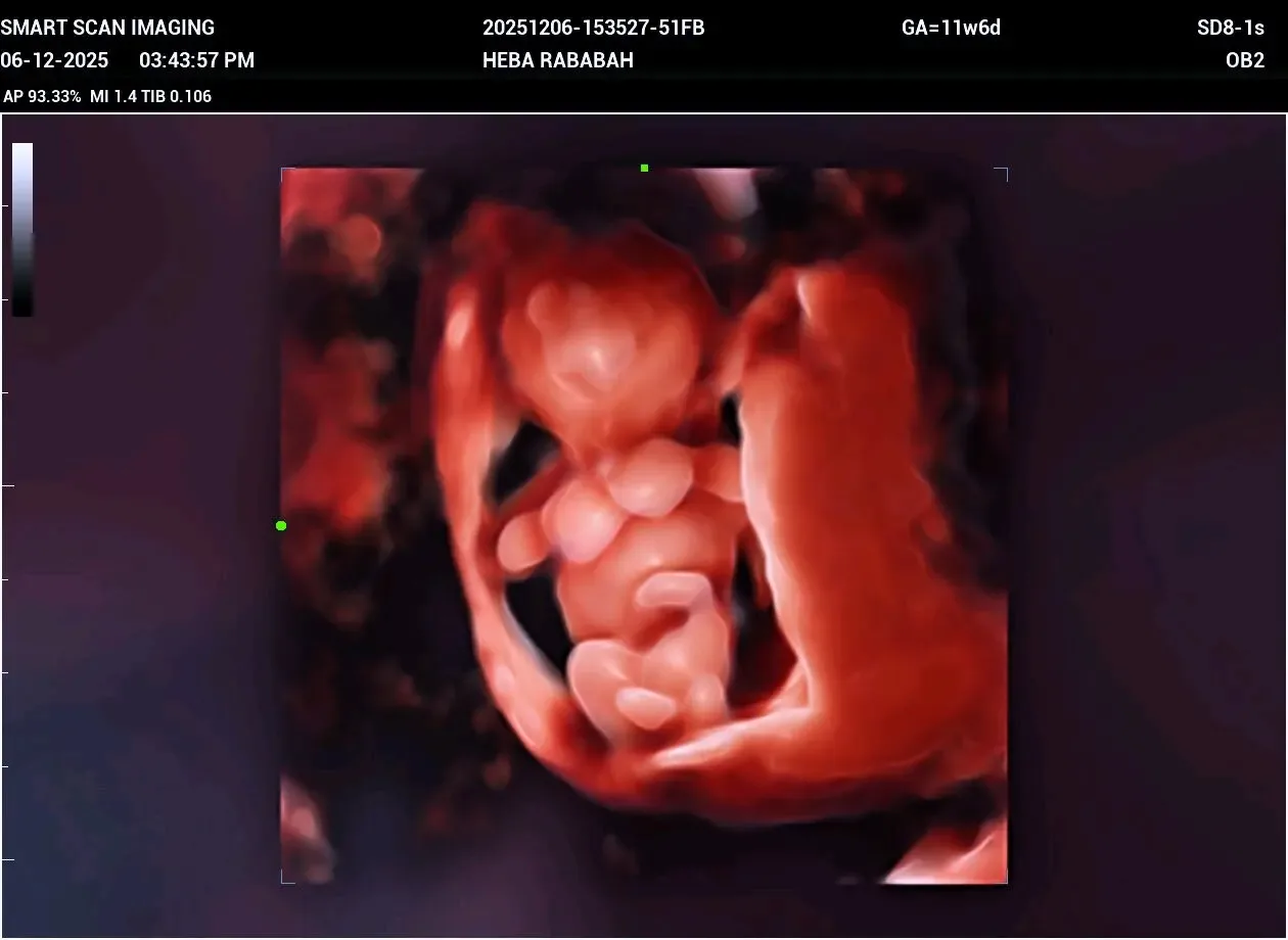 الدكتور مالك البياري (أخصائي نسائية و توليد