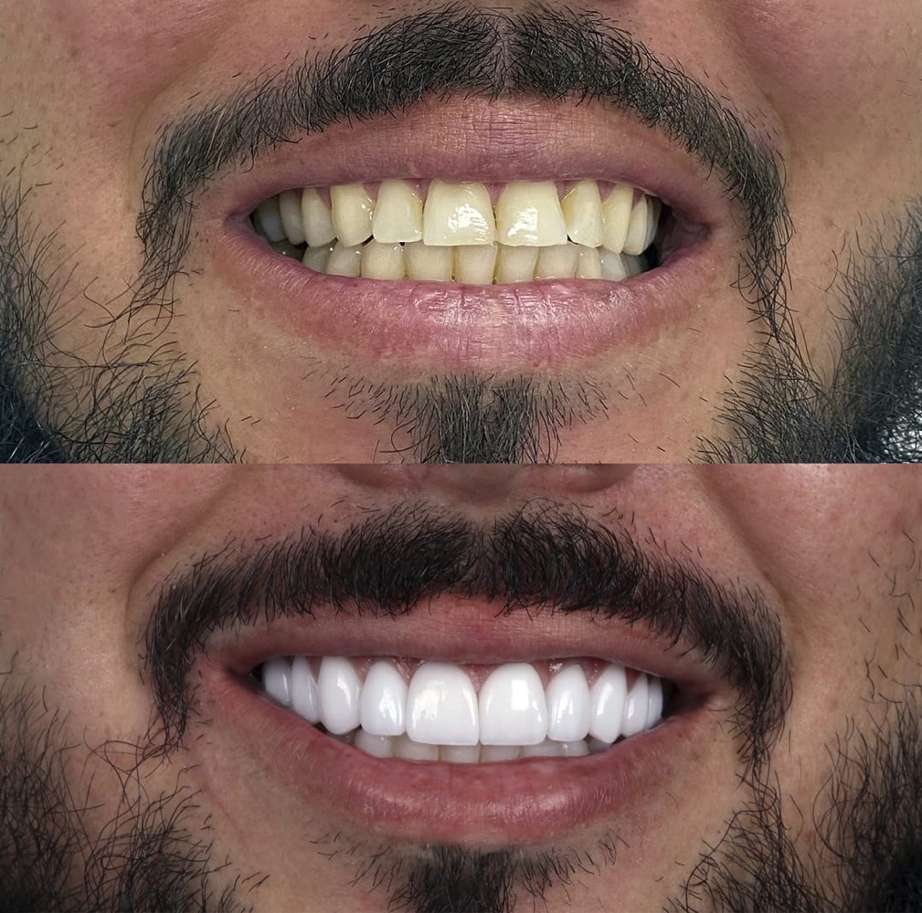 عيادة الدكتور صالح العليمي طب وجراحة الفم والأسنان
