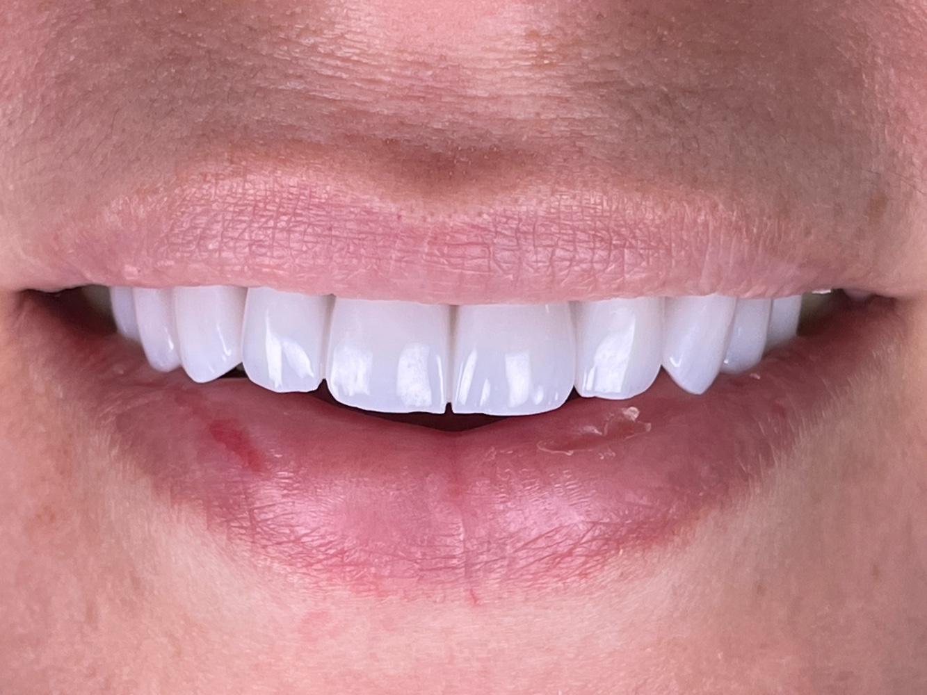 عيادة أسنان ، الدكتور نضال خليفة ، طبيب أسنان