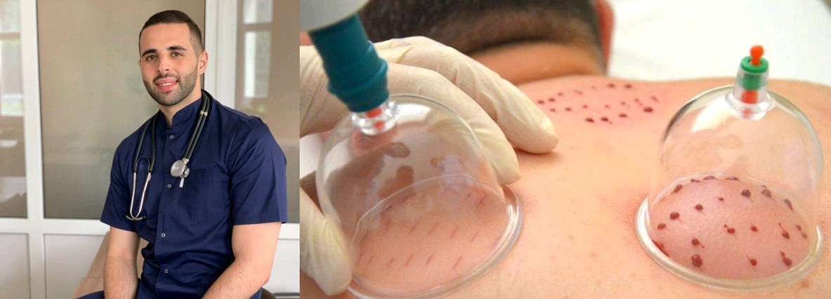 دكتور يزن للحجامه الطبيه